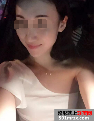 网友,分享,自体脂肪,移植,丰胸,手术,体会