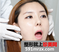 广空后勤,整形,医院,双鄂,颧骨,整形,假小子,逆袭,成为,萌妹子