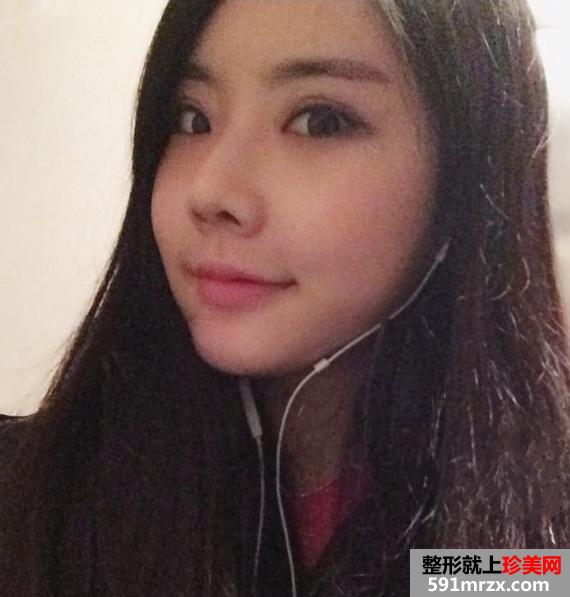 北京伊美尔健翔医院,北京驼峰鼻矫正多少钱