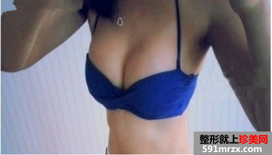 假体隆胸手术前后对比图 