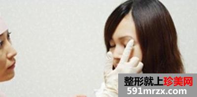 台州整形医院埋线双眼皮手术 告别“一单一双”