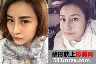 图片22.png