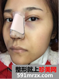 图片18.png