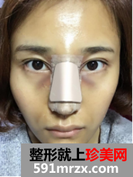 图片17.png