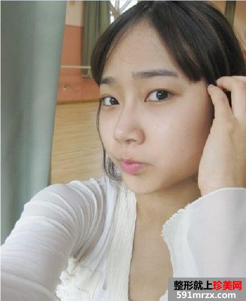 【真人案例】隆鼻5个月了，再画个妆吓倒你们。