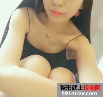 上海九院假体隆胸案例 假体隆胸恢复后图片