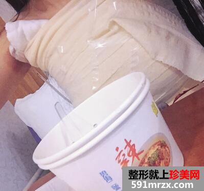 上海九院假体隆胸案例 假体隆胸恢复后图片