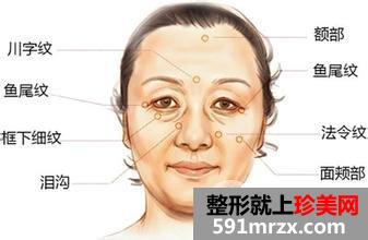 有法令纹怎么办有什么方法去除