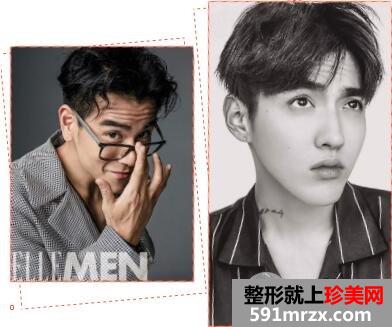 抬头纹治疗多少钱？方法有哪些？附案例效果对比图片~