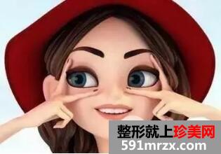 焊接双眼皮是什么？效果能管多久？附案例图片效果分享~