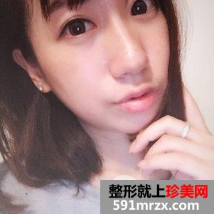 治疗鱼尾纹的方法8