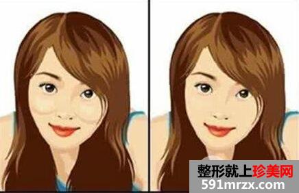 磨颧骨手术风险大吗？附上前后效果对比图