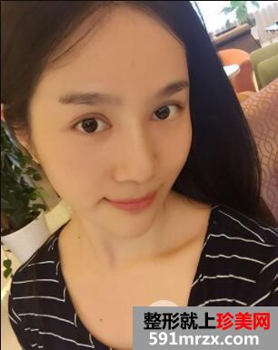 美白针整形案例