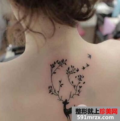 长春中研整形医院洗纹身价格