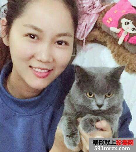 眉毛种植效果图3个月案例分享