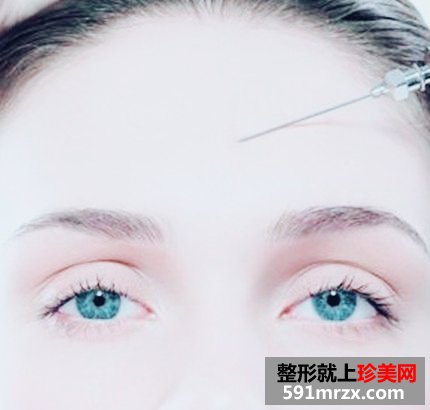 自体脂肪的特点