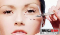 眼袋脂肪填泪沟安全吗