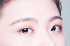 割双眼皮手术疼不疼