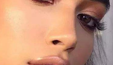 鼻翼缩小做完后几天能见人