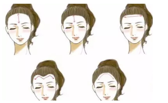如何把发际线变高