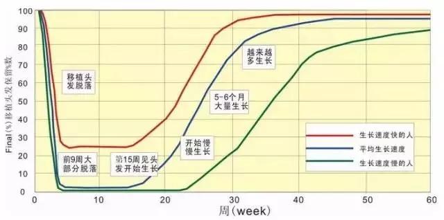 关于植发需要知道些什么？