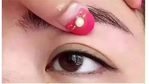 割双眼皮半个月宽窄不一样