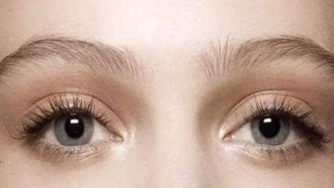 双眼皮完全恢复要多久