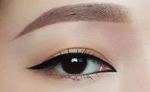 眼袋什么时候做最好