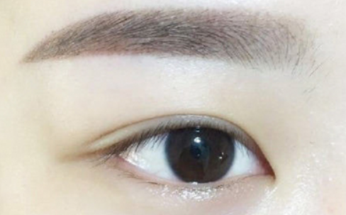做埋线双眼皮会导致脸歪么