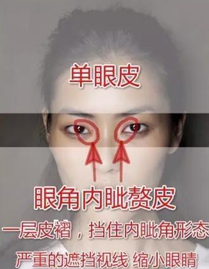 为什么做双眼皮手术医生总让我开眼角？让专家告诉你！