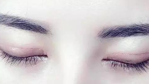 怎样有效让眼睛变双眼皮
