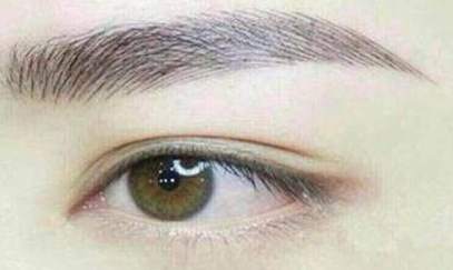 双眼皮整形漂亮吗