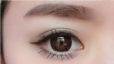 眼部修复手术注意事项是什么