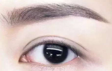 眼部修复手术要多少钱