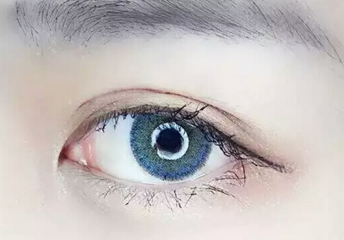 眼部埋线要多少钱