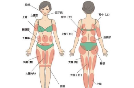 成都全身抽脂多少钱