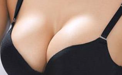 吸脂对副乳有效果吗