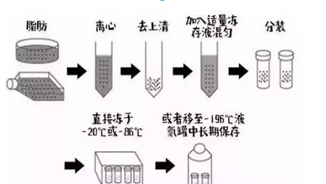脂肪冻存技术