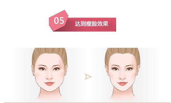 有效的瘦脸方法有哪些