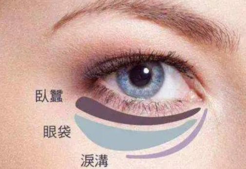 割眼袋会导致上眼下垂吗