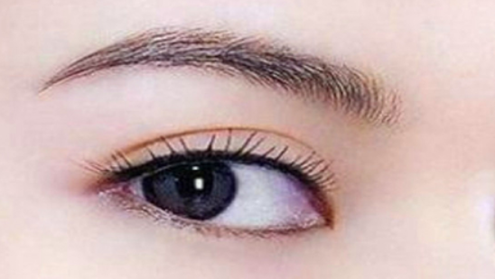 四十多岁眼角下垂怎么办