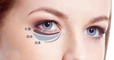 msq祛眼袋 下眼睑皮肤松弛矫正