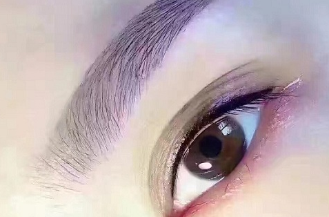 割眼袋效果好吗