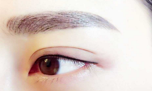 割眼袋疼不