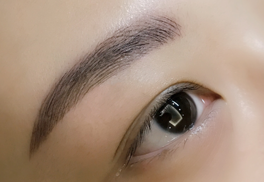 割眼袋留疤吗
