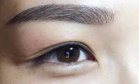 开眼角可以保持多久