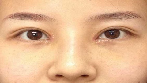 天津做眼角提升好的医美整形医院有哪些?