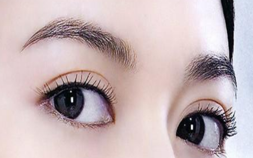 开眼角后需要擦什么吗