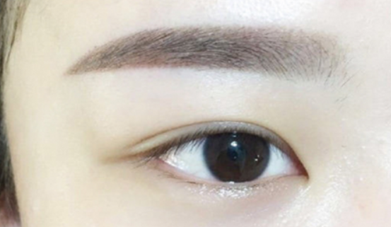 杭州做开眼角失败修复好的整形医院有哪些?