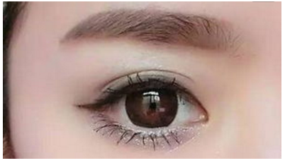 微创双眼皮手术后多久可以画眼妆